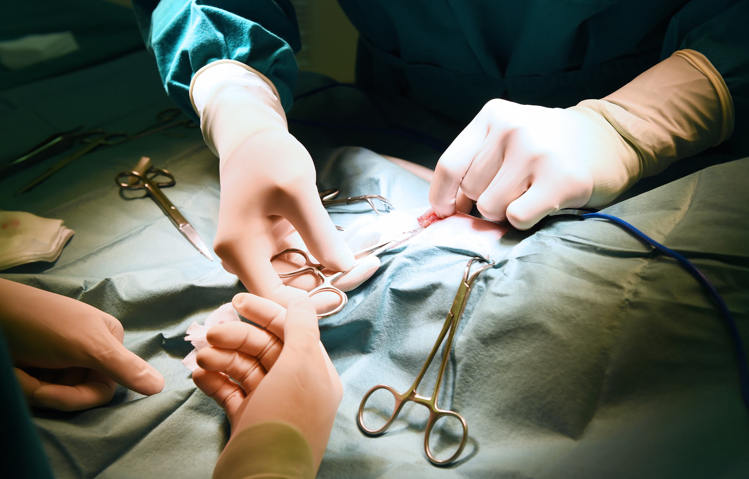 Hepatobiliary Surgery